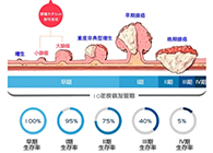 直肠癌早筛试剂盒“第一证”—足不出户而明察秋毫