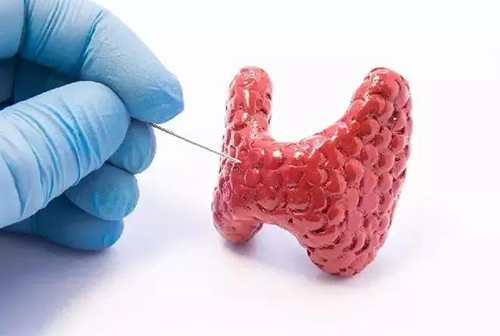 甲状腺疾病，包括甲状腺功能减退和甲状腺功能亢进，自古以来就是反复被医学研究人员研究的疾病